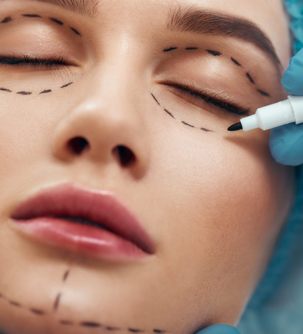 Becoming perfect. Close up photo of young woman with glowing skin in blue medical hat waiting for facial surgery while plastic surgeon in blue gloves drawing dashed line under eyes. Beauty concept. Facelift. Plastic surgery