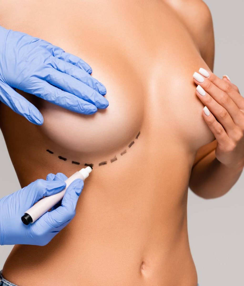 cropped-view-of-plastic-surgeon-marking-line-on-br-2023-11-27-05-12-31-utc (1)